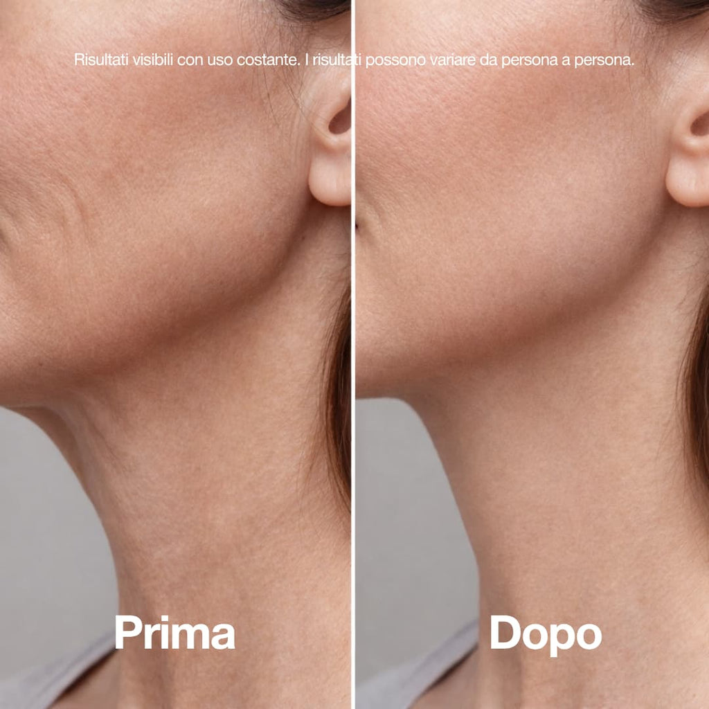 Stick Lifting al Collagene Rosa e PDRN